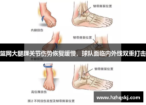 篮网大腿踝关节伤势恢复缓慢，球队面临内外线双重打击